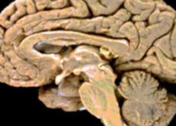 cerebro humano real etiquetado